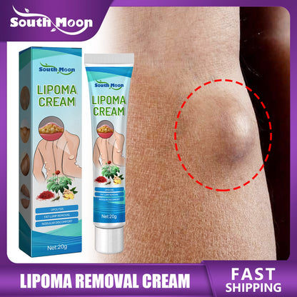 Lipoma Removal Cream Relief Pain Treat Skin Swelling Lipolysis Cellulite Fat Lump Nodule Removal Ointment Anti-tumor Plaster