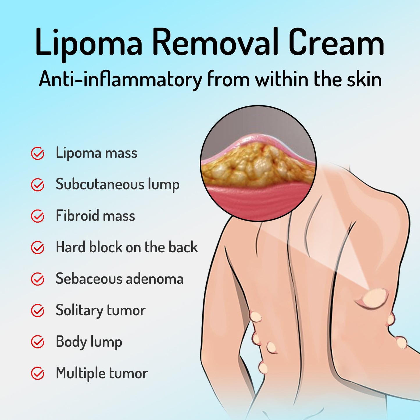 Lipoma Removal Cream Relief Pain Treat Skin Swelling Lipolysis Cellulite Fat Lump Nodule Removal Ointment Anti-tumor Plaster