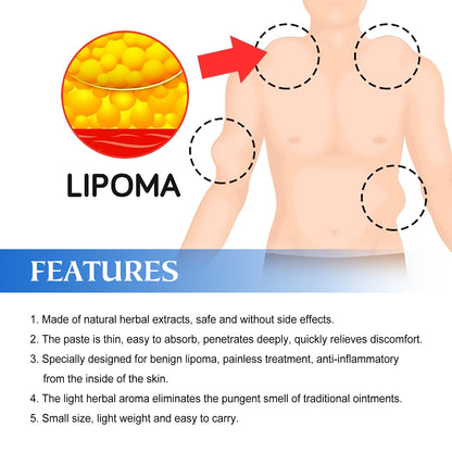Lipoma Removal Cream Relief Pain Treat Skin Swelling Lipolysis Cellulite Fat Lump Nodule Removal Ointment Anti-tumor Plaster